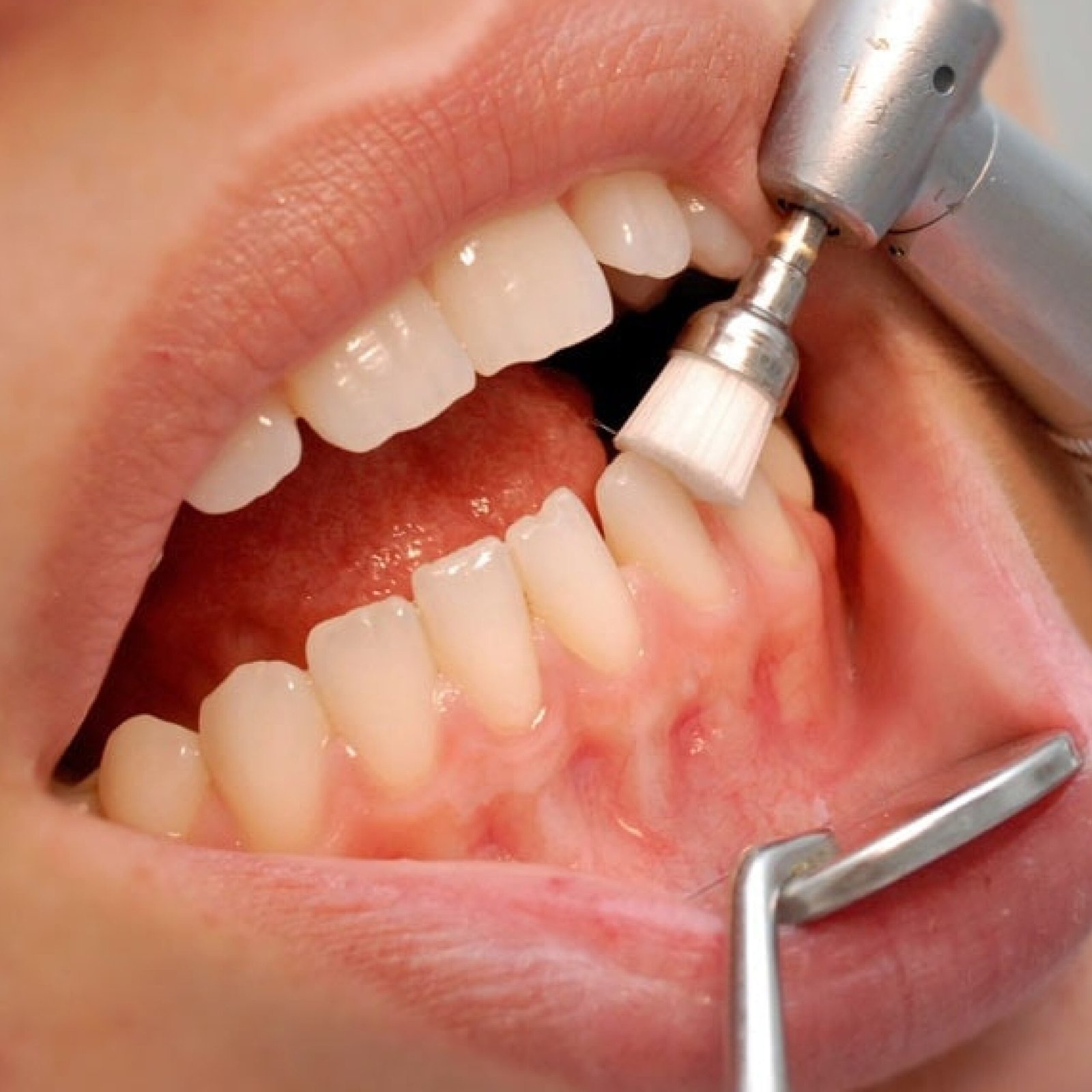 Periodoncia