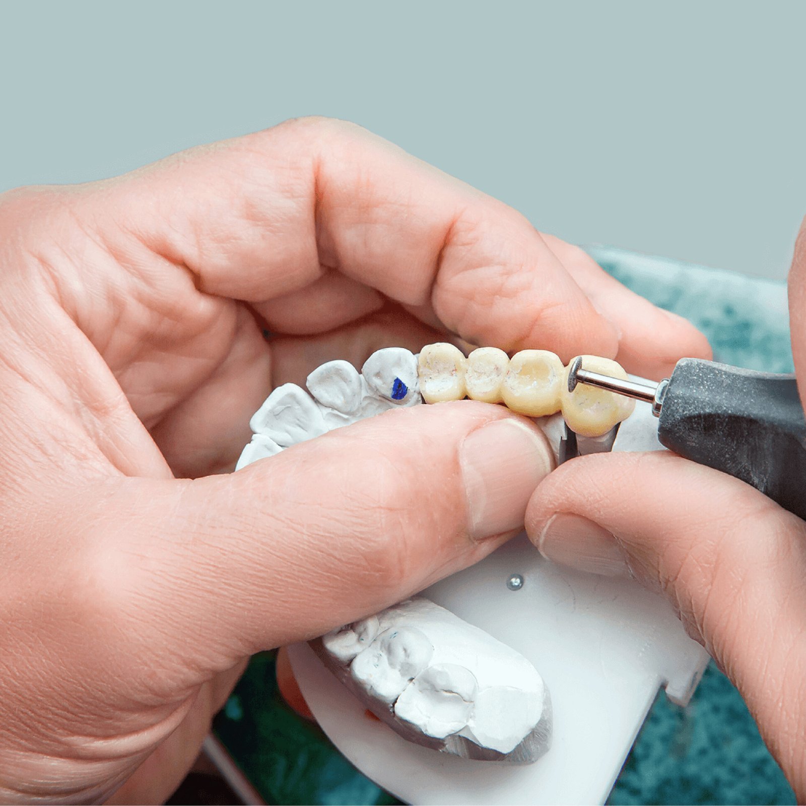 Laboratorio Dental
