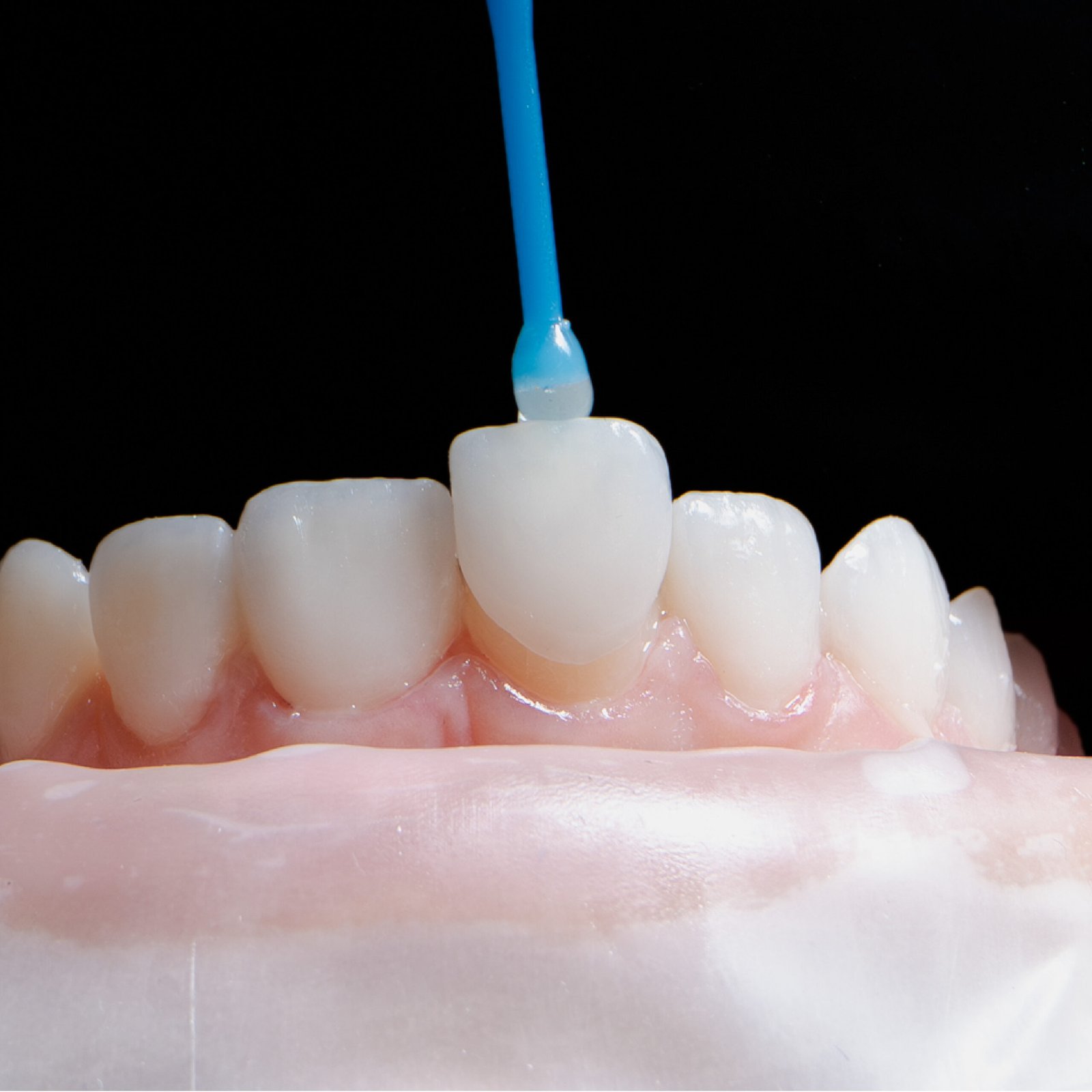 Estética Dental
